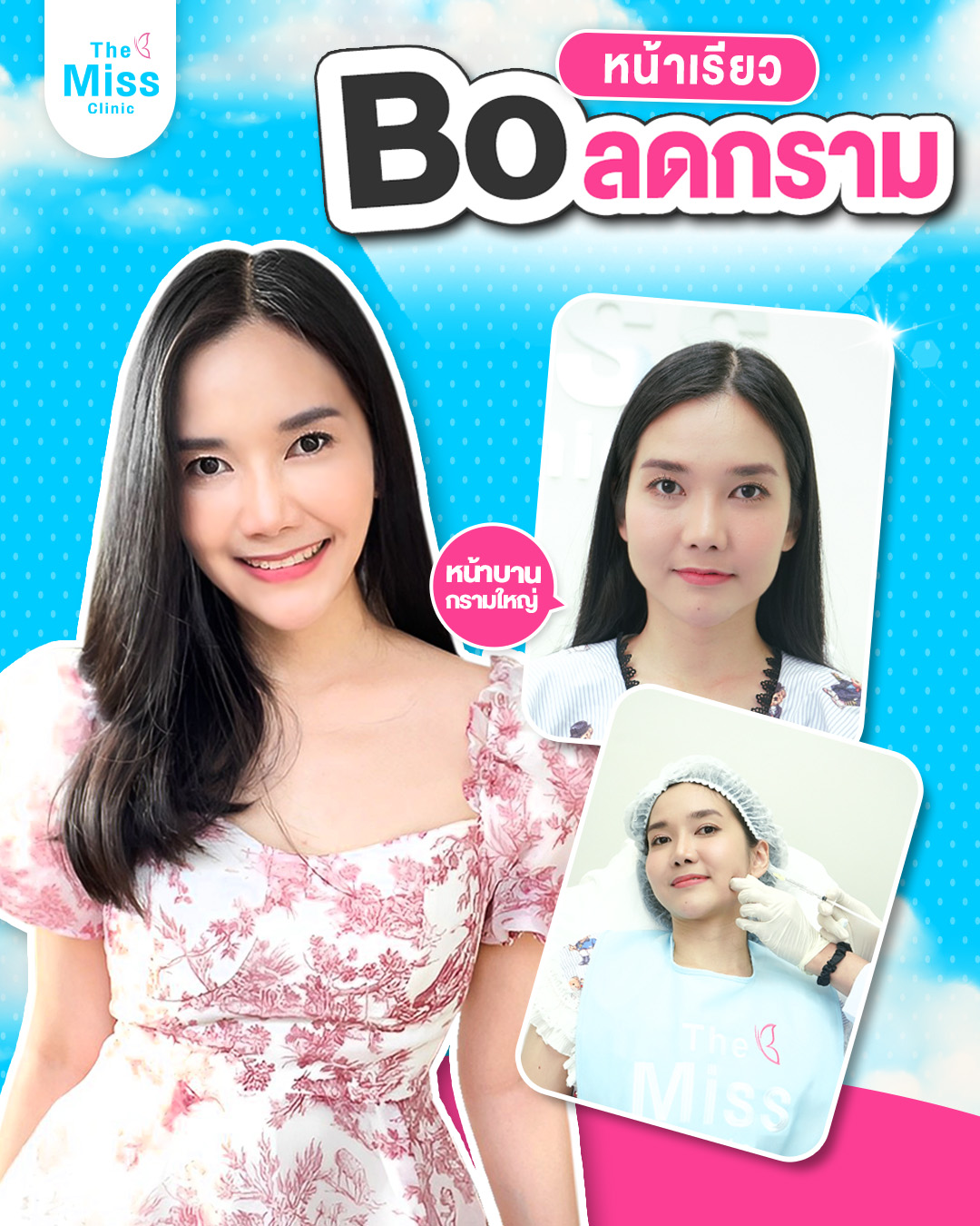 ฉีดโบท็อก ตรงไหนดี ?