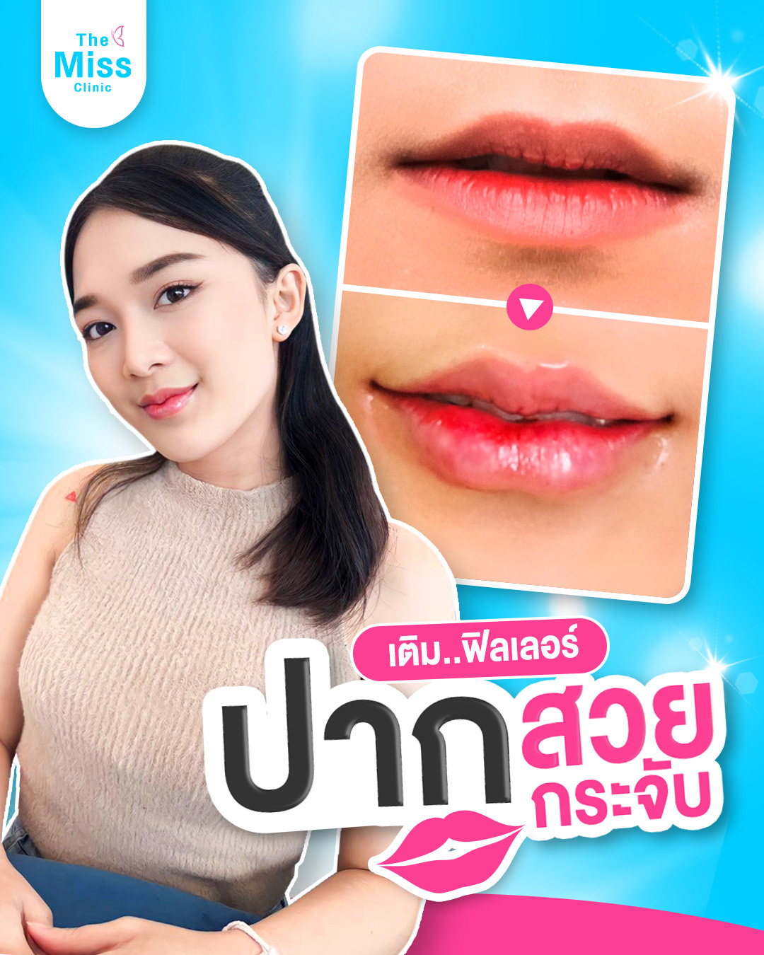 ฟิลเลอร์