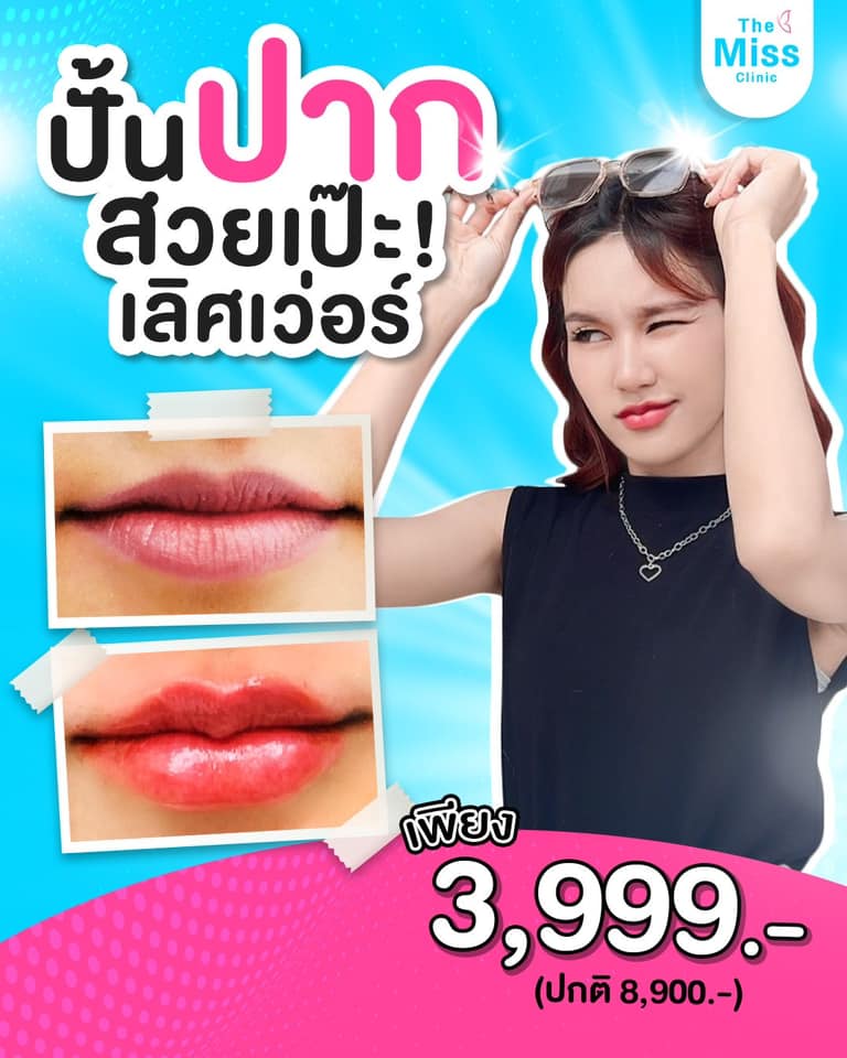 ฟิลเลอร์