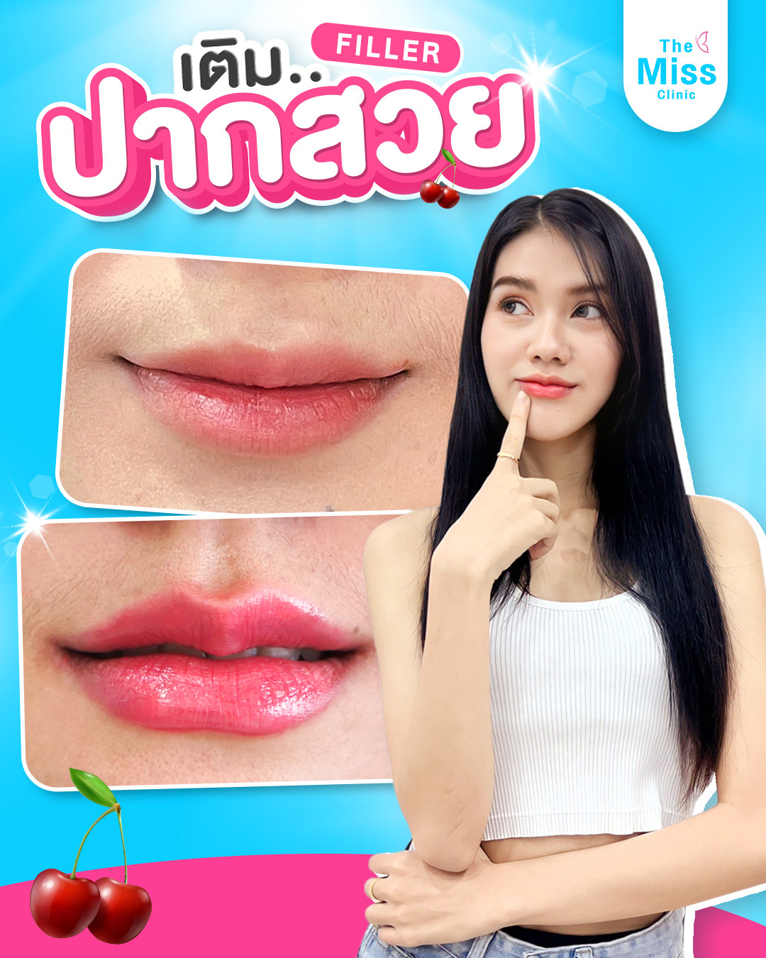 ฟิลเลอร์