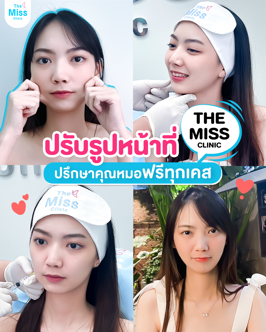 ฟิลเลอร์