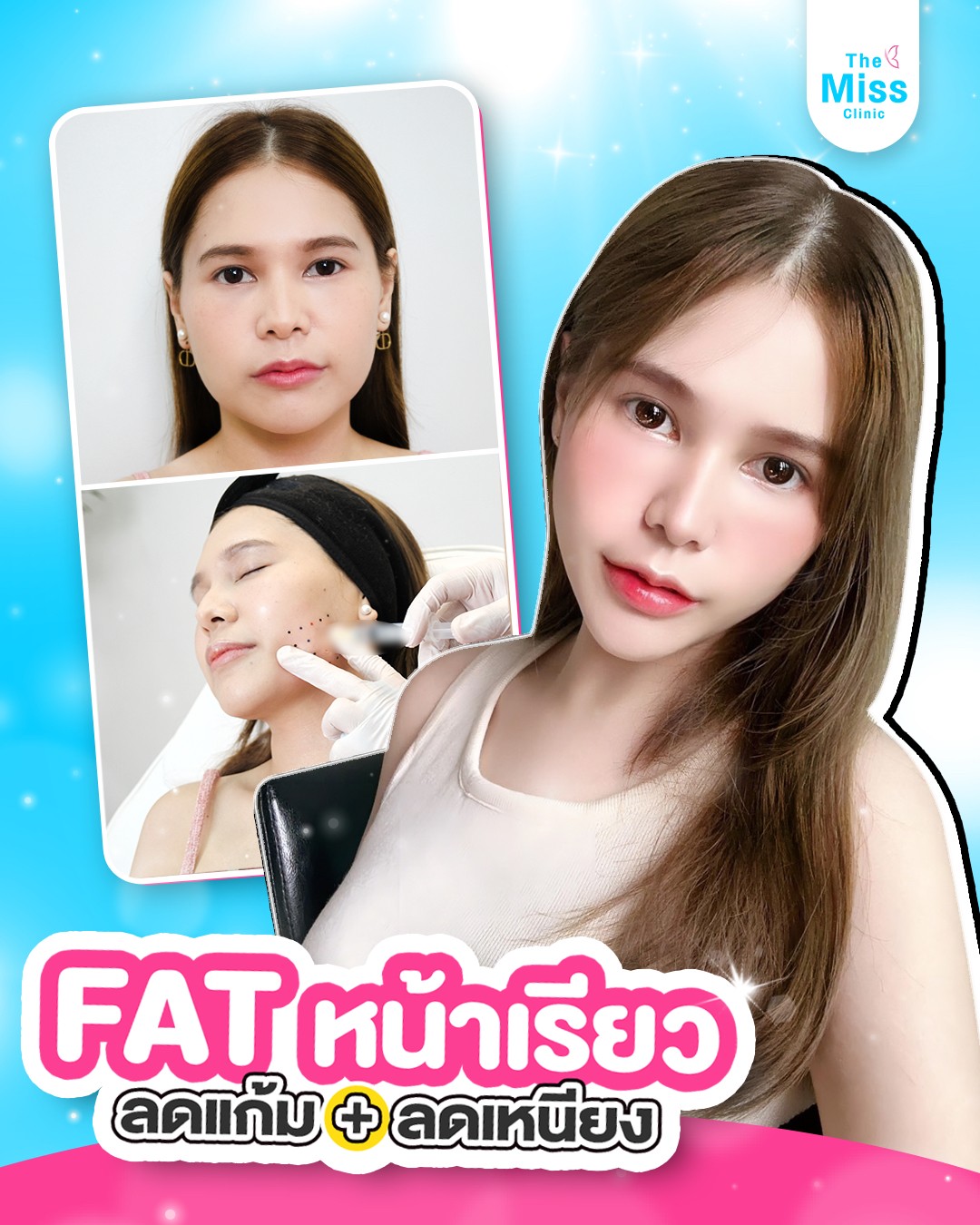 รีวิว Meso fat