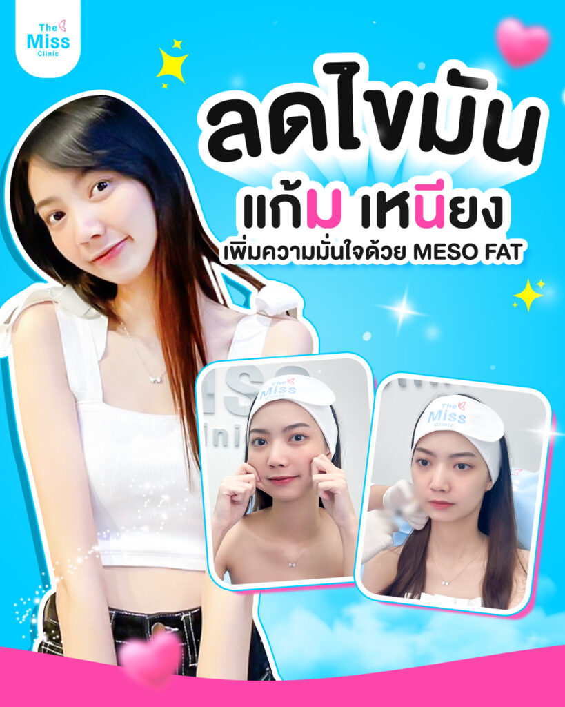 รีวิว Meso fat