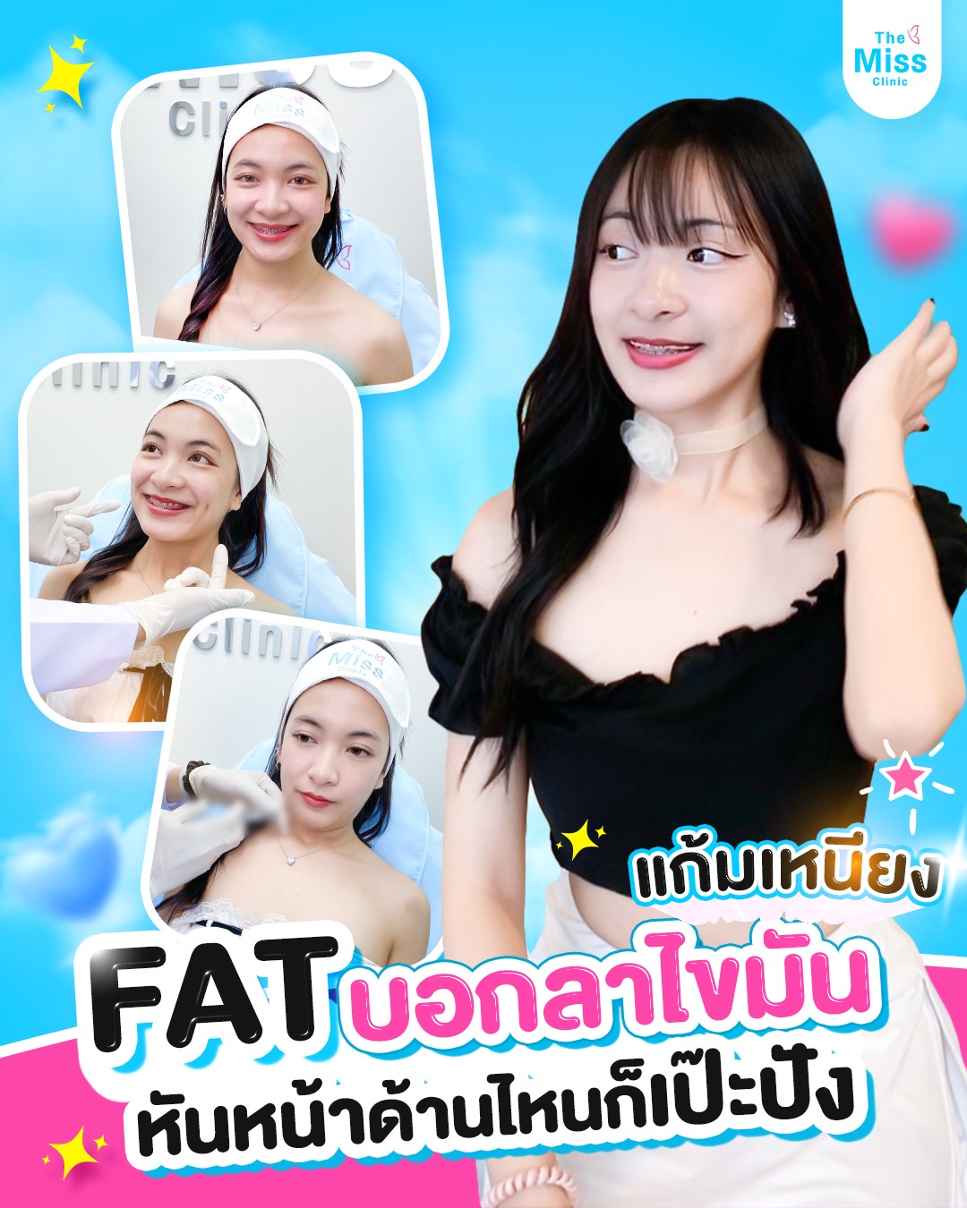 รีวิว Meso fat