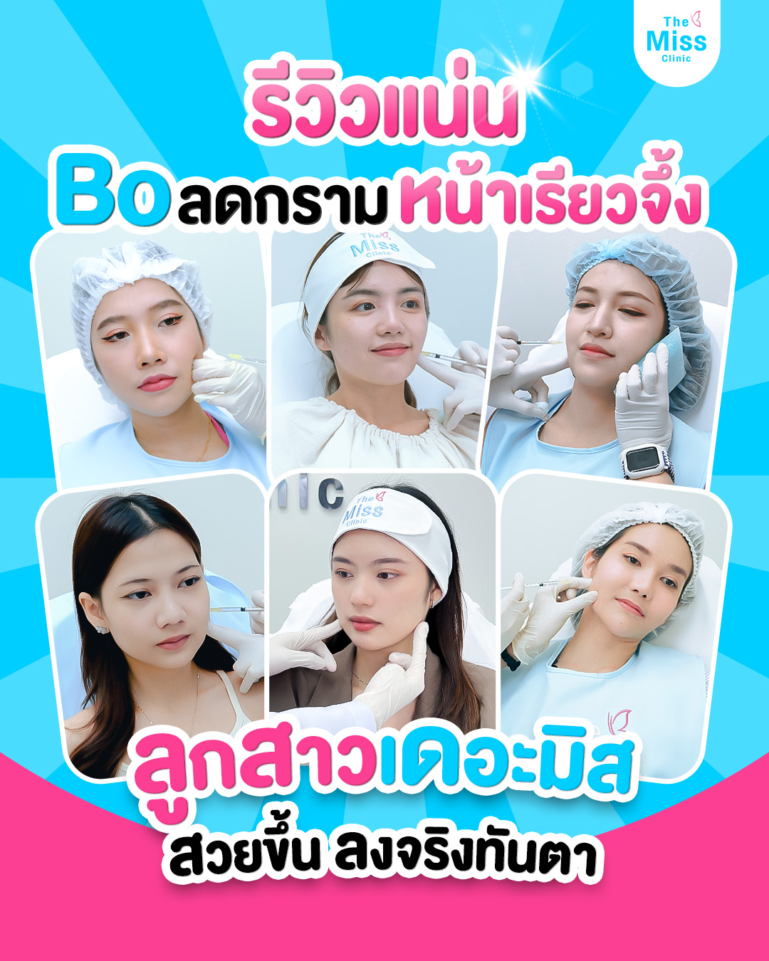 โบท็อกซ์ คืออะไร